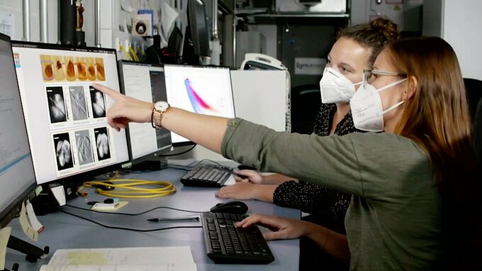 Dunkelfeld-Röntgenaufnahmen können die Schädigungen des Lungengewebes durch Erkrankungen wie COPD oder Covid-19 sichtbar machen.