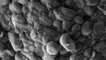 Rasterelektronenmikroskopische Aufnahme des untersuchten Elektrodenmaterials